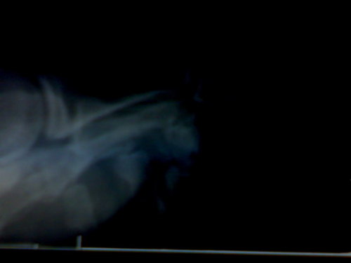 Lateral x-ray right great toe